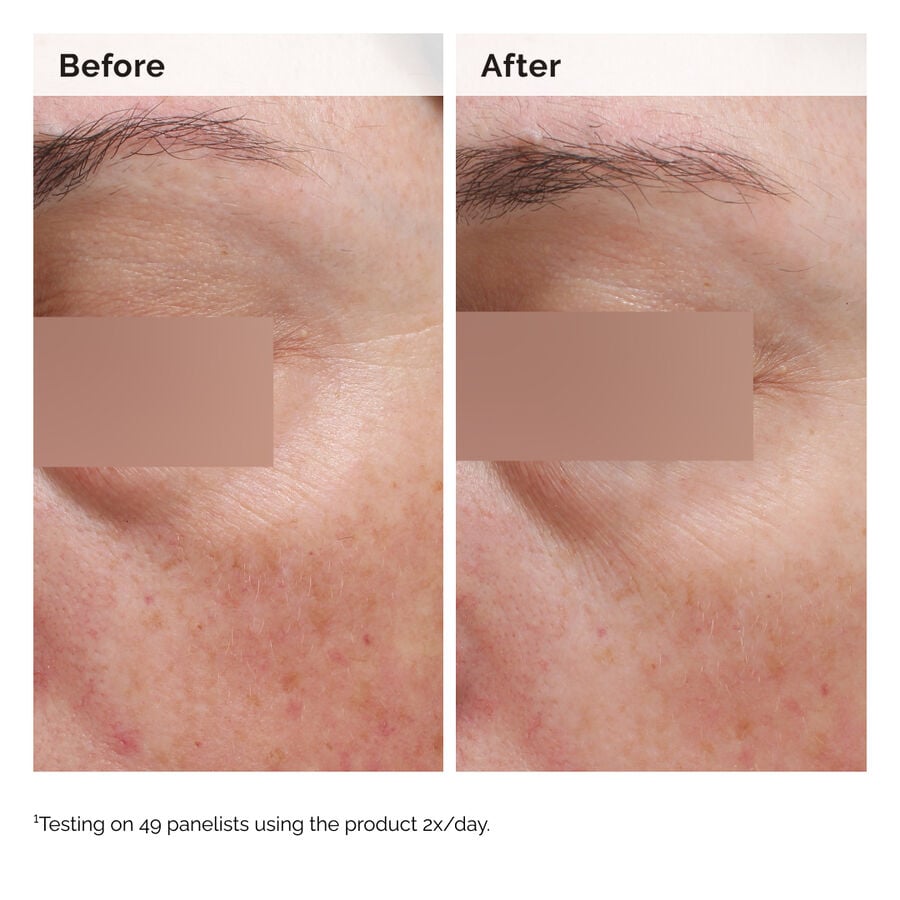 niacinamide-5-face-and-body-emulsion-f2 2024-08-23-ORD-Nia-5pct-Face-Body-B-A-Elasticity-Global-02-1x1.jpg