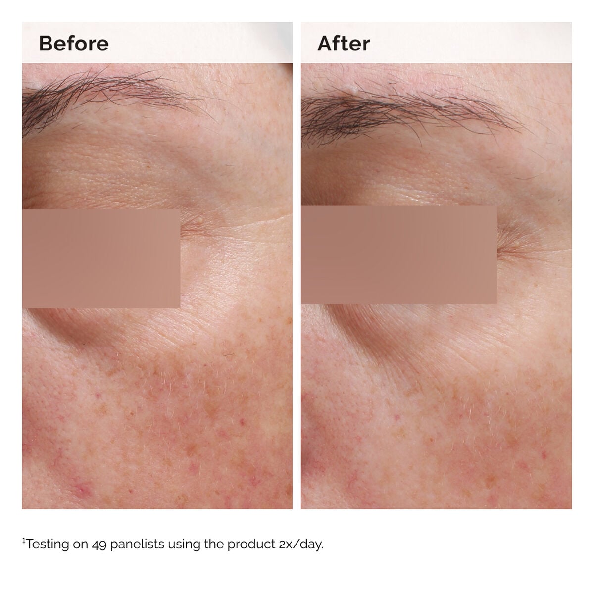 niacinamide-5-face-and-body-emulsion-f2 2024-08-23-ORD-Nia-5pct-Face-Body-B-A-Elasticity-Global-02-1x1.jpg
