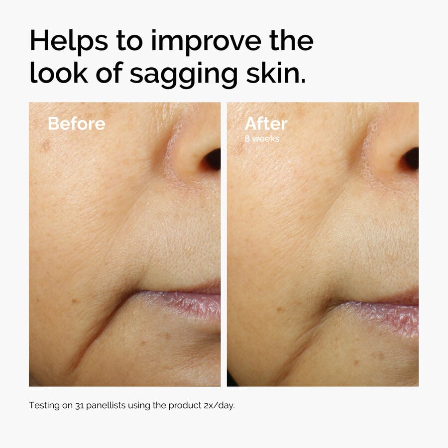 caffeine-3-escin-1-face-serum-q2 ord-caffeine-3pct-escin-1pct-face-serum-before-after-sagging.jpg