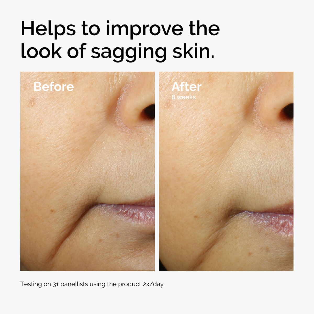 caffeine-3-escin-1-face-serum-q2 ord-caffeine-3pct-escin-1pct-face-serum-before-after-sagging.jpg