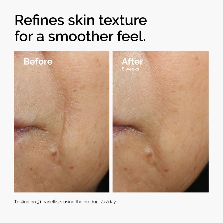 caffeine-3-escin-1-face-serum-q2 ord-caffeine-3pct-escin-1pct-face-serum-before-after-texture.jpg