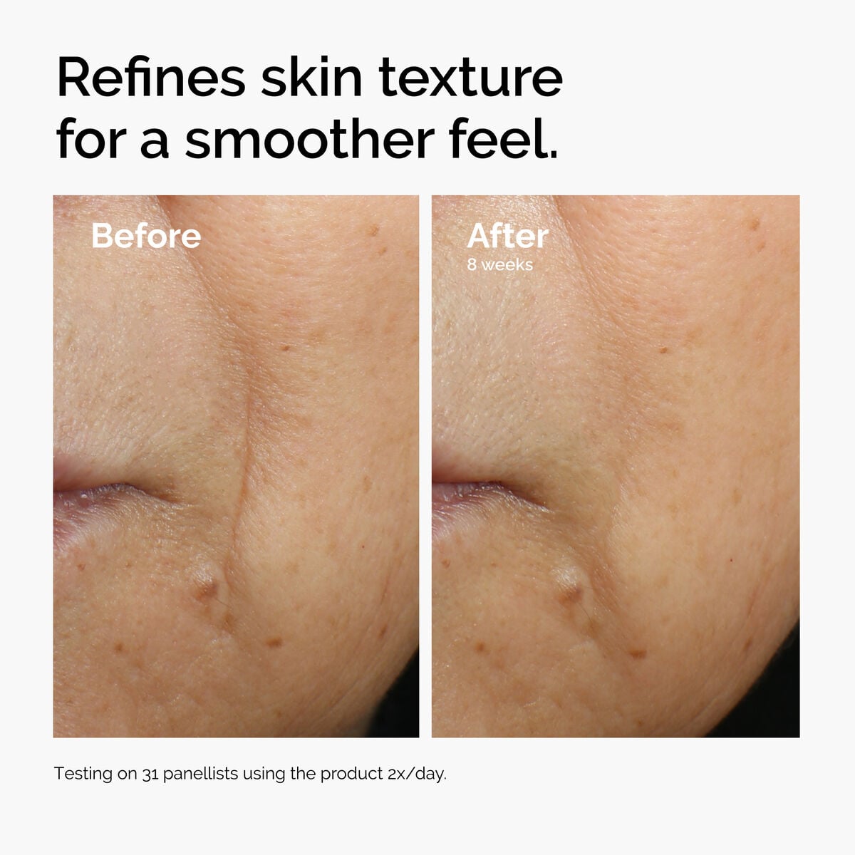 caffeine-3-escin-1-face-serum-q2 ord-caffeine-3pct-escin-1pct-face-serum-before-after-texture.jpg