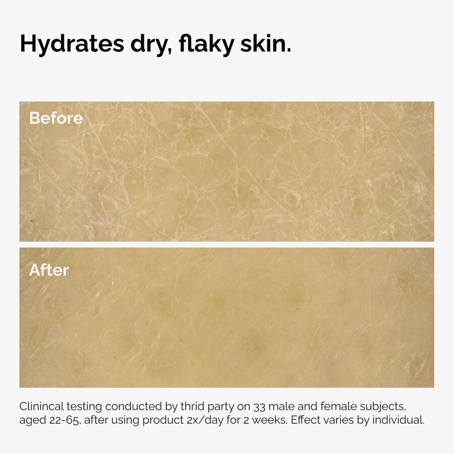 the-body-care-collection-e3 ord-natural-moisturizing-factors-inulin-body-before-after-graphic-02.jpg