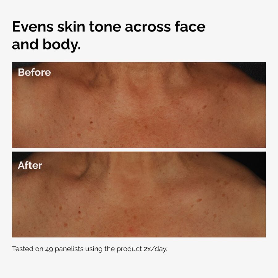 the-body-care-collection-e3 ord-niacinamide-face-body-serum-before-after-even-tone-graphic.jpg