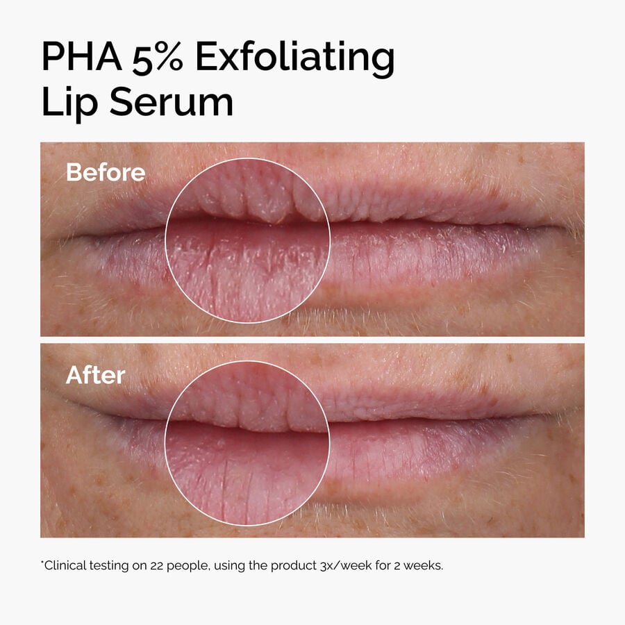 pha-5-exfoliating-lip-serum-t9 ord-pha-5pct-lip-exfoliating-serum-before-after.jpg