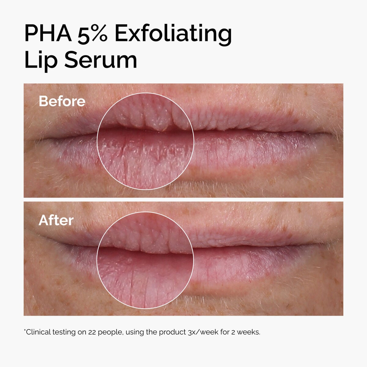 pha-5-exfoliating-lip-serum-t9 ord-pha-5pct-lip-exfoliating-serum-before-after.jpg