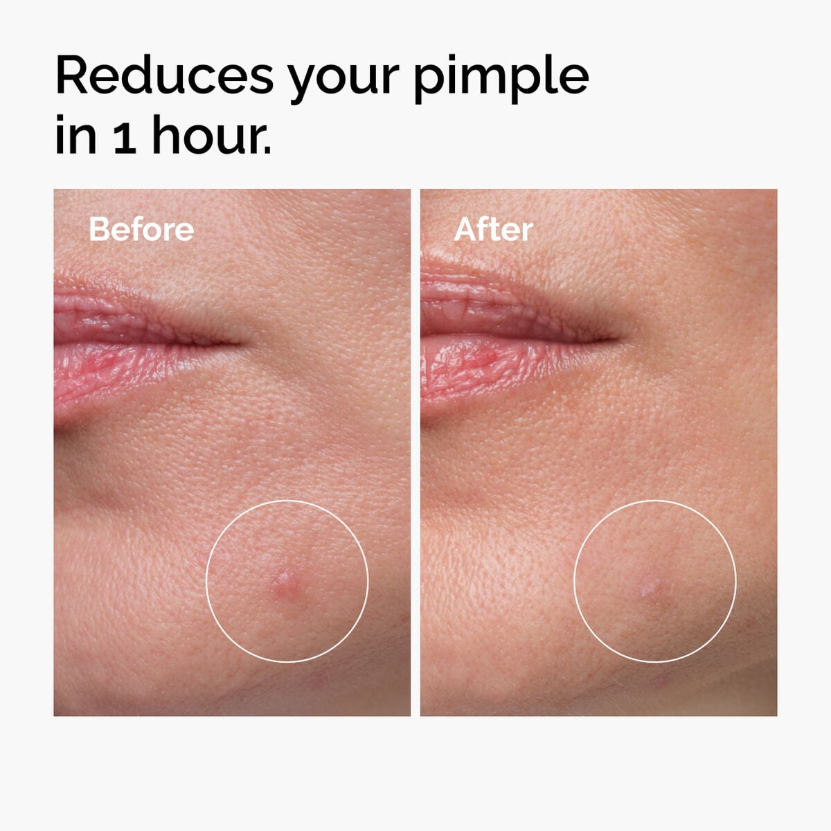 sulfur-10-powder-to-cream-concentrate-j0 ord-sulfur-10pct-powder-to-cream-concentrate-before-after-NA.jpg