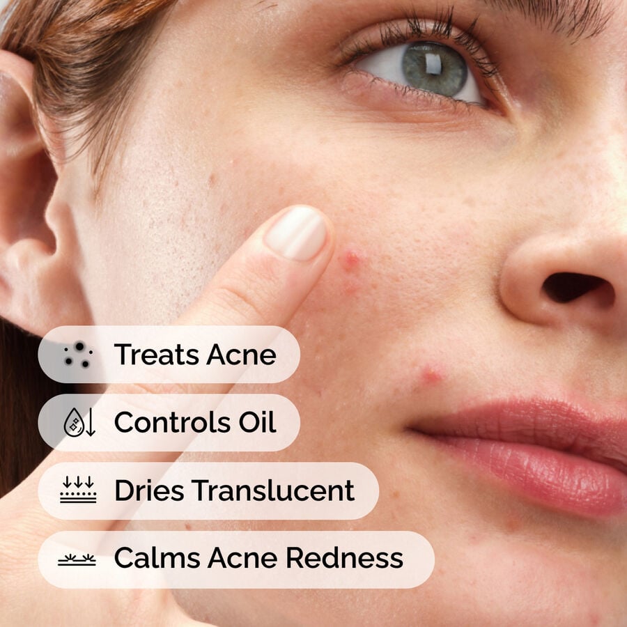 sulfur-10-powder-to-cream-concentrate-j0 ord-sulfur-10pct-powder-to-cream-concentrate-model-application-with-benefits-acne.jpg